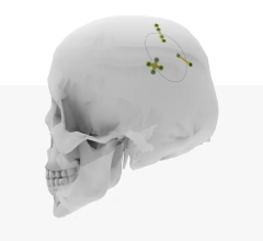Neuro