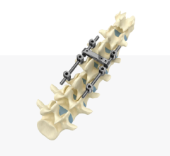 Thoracic & Lumber Spine Segment